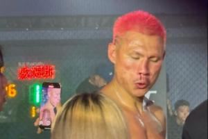 🤯太狠！恶鼠被威姆斯一拳打到鼻梁已经出现歪斜！